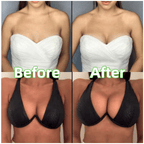 CurvaLift™ — Unlock Head-Turning Curves That Stay Perfect All Day