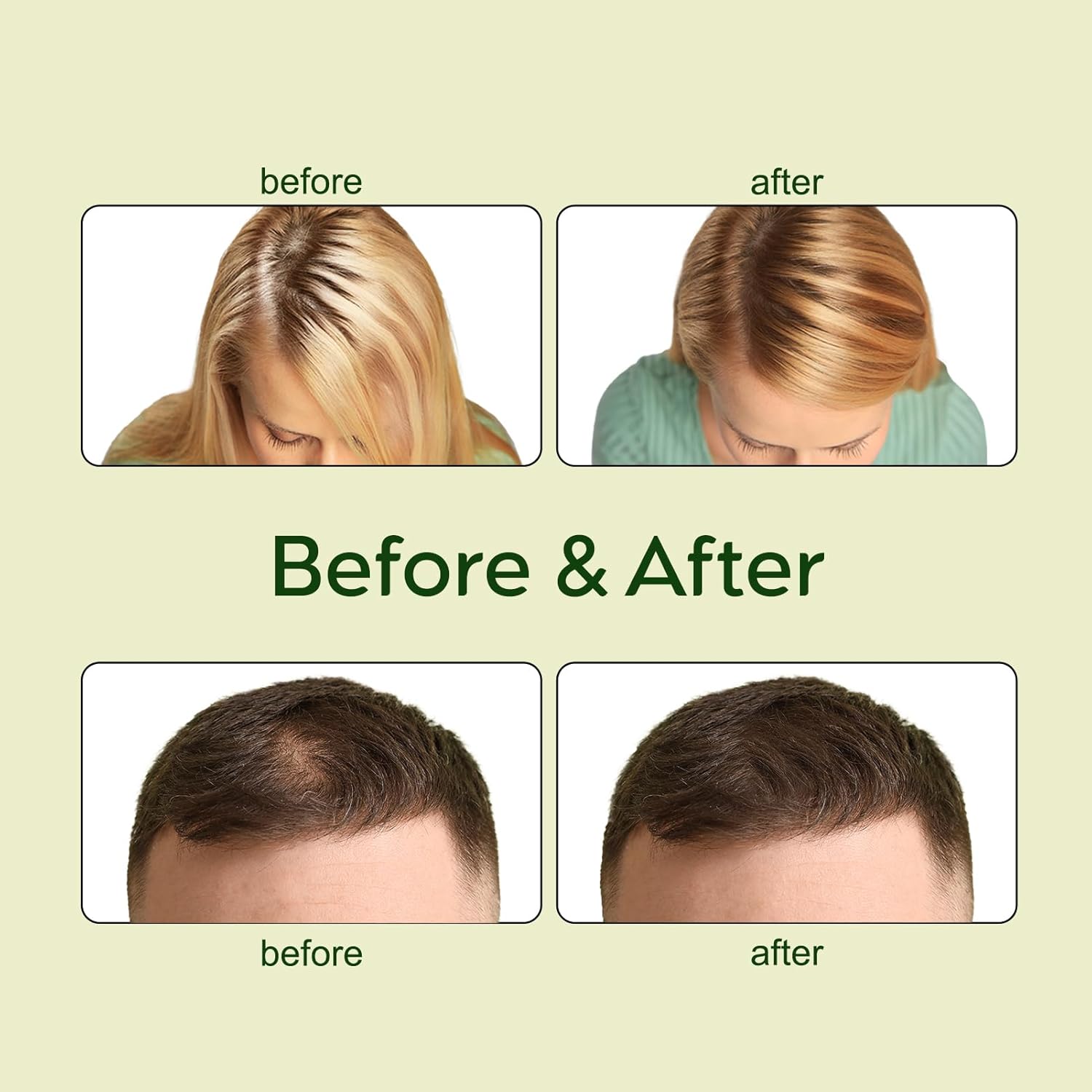 RamaraBoost™ — Unlock Lush, Head-Turning Hair That Radiates Confidence