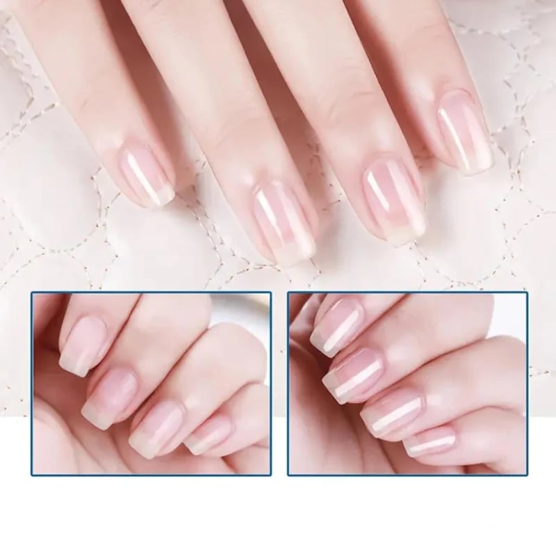 LumaNail™ — Transform Fragile Nails into Confident, Head-Turning Strength in Just Days