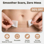 VeluDerm™ Silicone Scar Sheet Roll — Finally Reveal Smooth, Confident Skin You’re Proud To Show