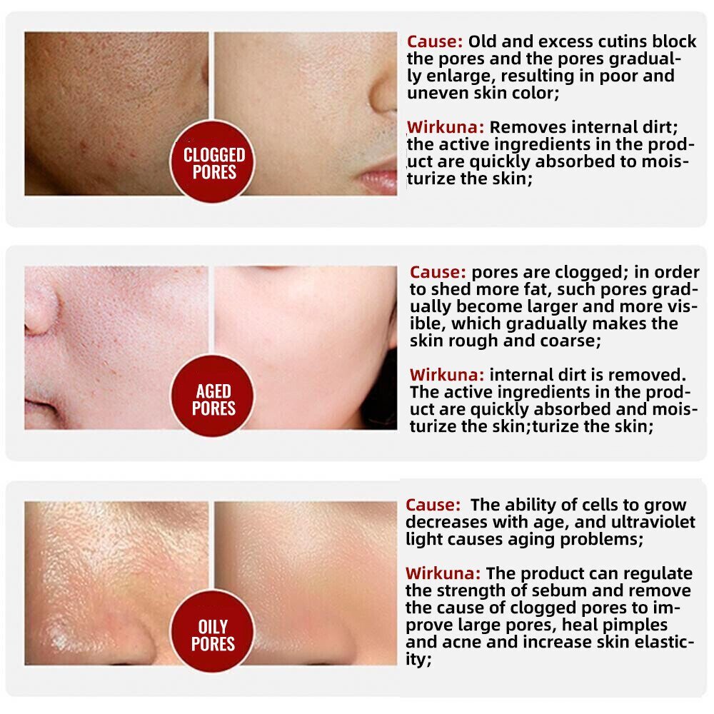 Pure Radiance™ — Instantly Blur Pores and Glow with Youthful Confidence