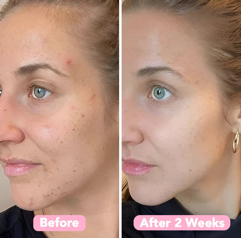 GlowLuxe™ — Wake Up to Radiant, Spot-Free Skin Every Day