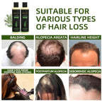 RamoraRoot™ — Unlock Thick, Lush Hair That Feels Alive and Strong Every Day