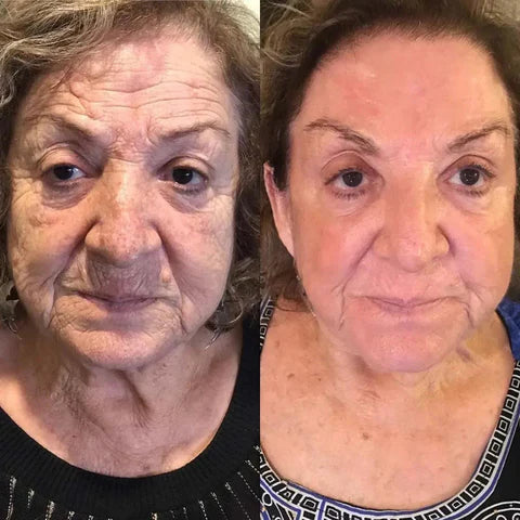 VeloraMist™ — Melt Away Pain and Glow with Youthful, Soothing Relief