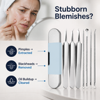 Velyndra™ Precision Extraction Kit — Unlock Soft, Clear Skin You’ll Love to Show Off