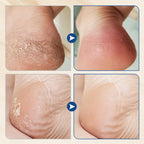 SoleSerene™ — Transform Your Feet into a Silky, Crack-Free Comfort Zone