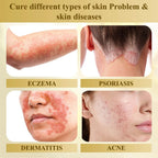 DermaLuxe™ — Melt Away Skin Flaws and Glow with Unstoppable Confidence