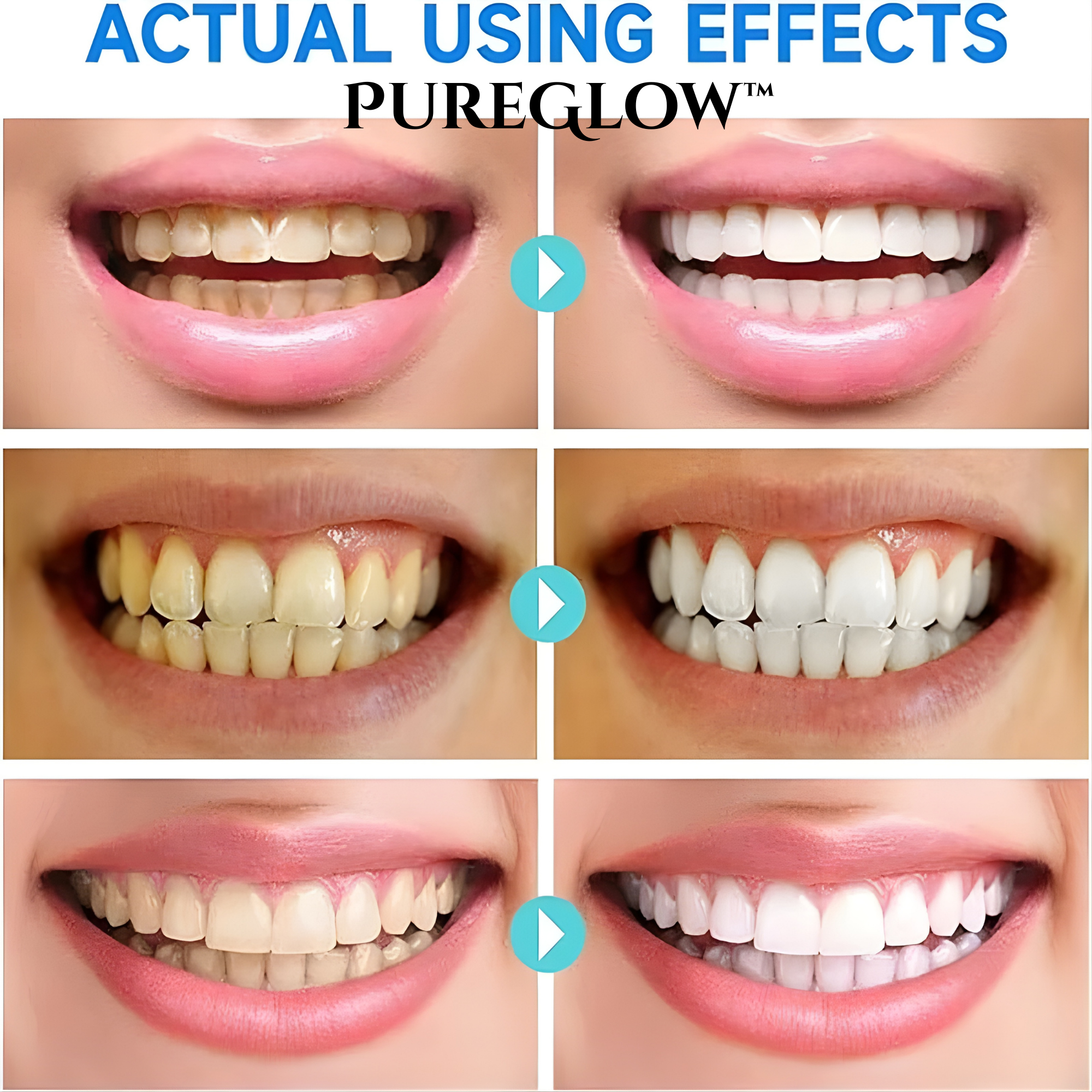 GlowLift™ — Instantly Unleash a Brighter, Stronger Smile That Commands Attention