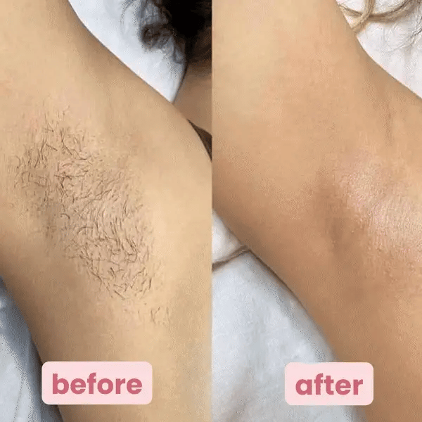 SilkMira™ — Unlock Silky Skin That Feels Like Pure Confidence