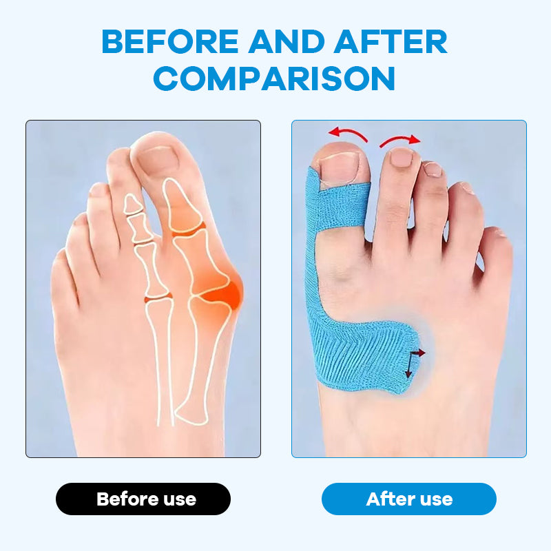 GlideAlign™ — Finally Walk Pain-Free with Invisible, All-Day Bunion Relief