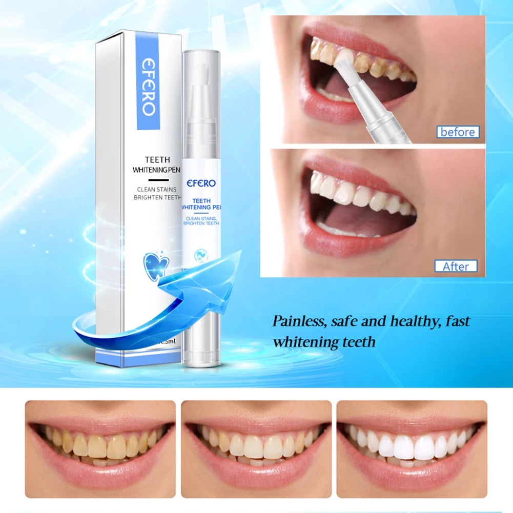 RadianceRush™ — Effortless Whitening That Ignites Unstoppable Confidence