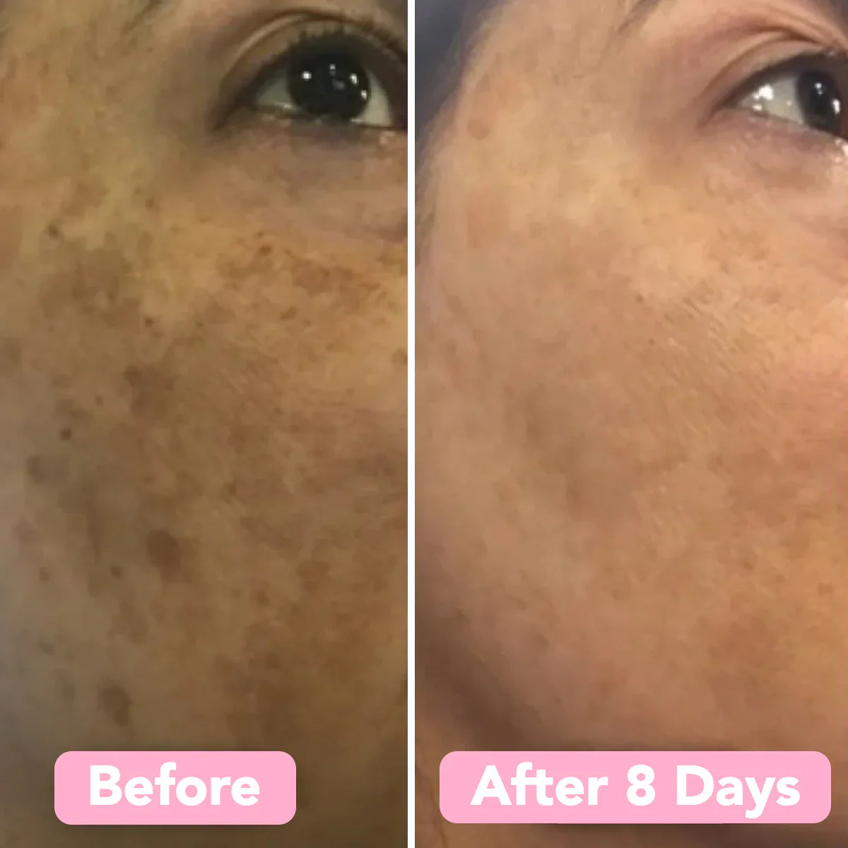 GlowLuxe™ — Wake Up to Radiant, Spot-Free Skin Every Day