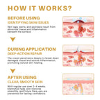 DermaLuxe™ — Melt Away Skin Flaws and Glow with Unstoppable Confidence