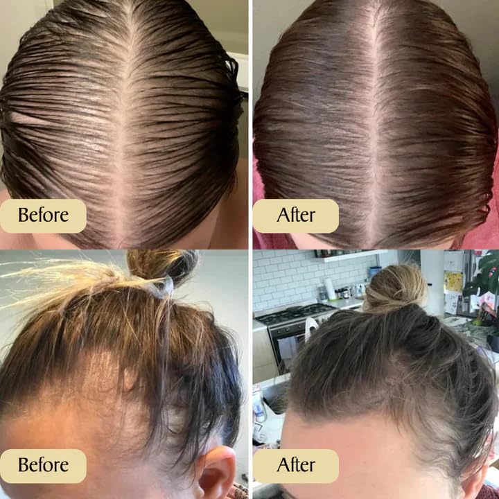 RamaraBoost™ — Unlock Lush, Head-Turning Hair That Radiates Confidence