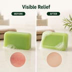 OriginDerm™ — Crush Deep Itch and Feel Unstoppable Confidence Every Day