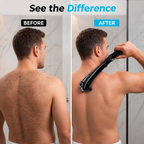 TitanEdge™ — Take Control for a Smooth, Confident Back Without the Struggle