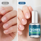Shynelle™ — Transform Brittle Nails into Stunning Strength and Shine in Just Days