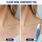 Silqora™ — Effortlessly Reveal Smooth, Tag-Free Skin You’ll Love to Show Off