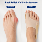 StrideSoothe™ — Walk Free from Bunion Pain and Feel Unstoppable Comfort
