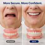 Dentivora™ Full Denture — Lock in Your Smile and Confidence All Day Long