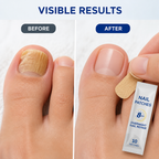 DermalReign™ — Unleash Stunning Nails That Radiate Confidence Every Day
