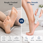 SilkStride™ Electric Foot Refiner — Reveal irresistibly soft feet that boost your confidence every step you take