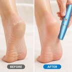 Pedivanta™ — Reveal Irresistibly Soft, Show-Off-Ready Feet Instantly