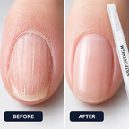 Tipsora™ — Give Brittle Nails a Smoother, Healthier-Looking Comeback
