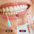 Ramellea™ — Take Control of Your Freshest, Healthiest Smile Everywhere You Go