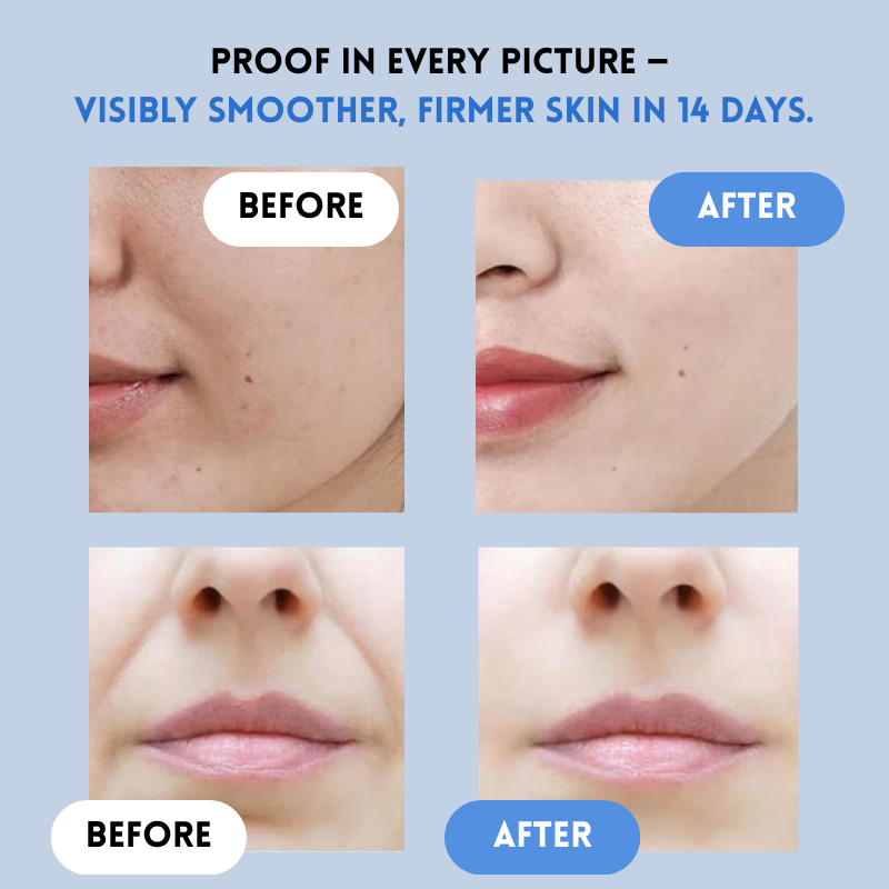 VivaLuxe™ Lift Strips — Instantly Reveal Firmer, Younger Skin That Radiates Confidence