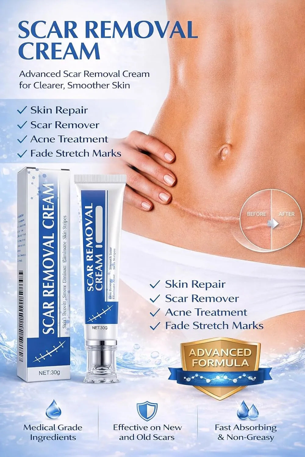 ScarEase™ — Unlock Radiant Skin That Erases Every Scar and Boosts Your Confidence