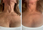 VeloraMist™ — Melt Away Pain and Glow with Youthful, Soothing Relief