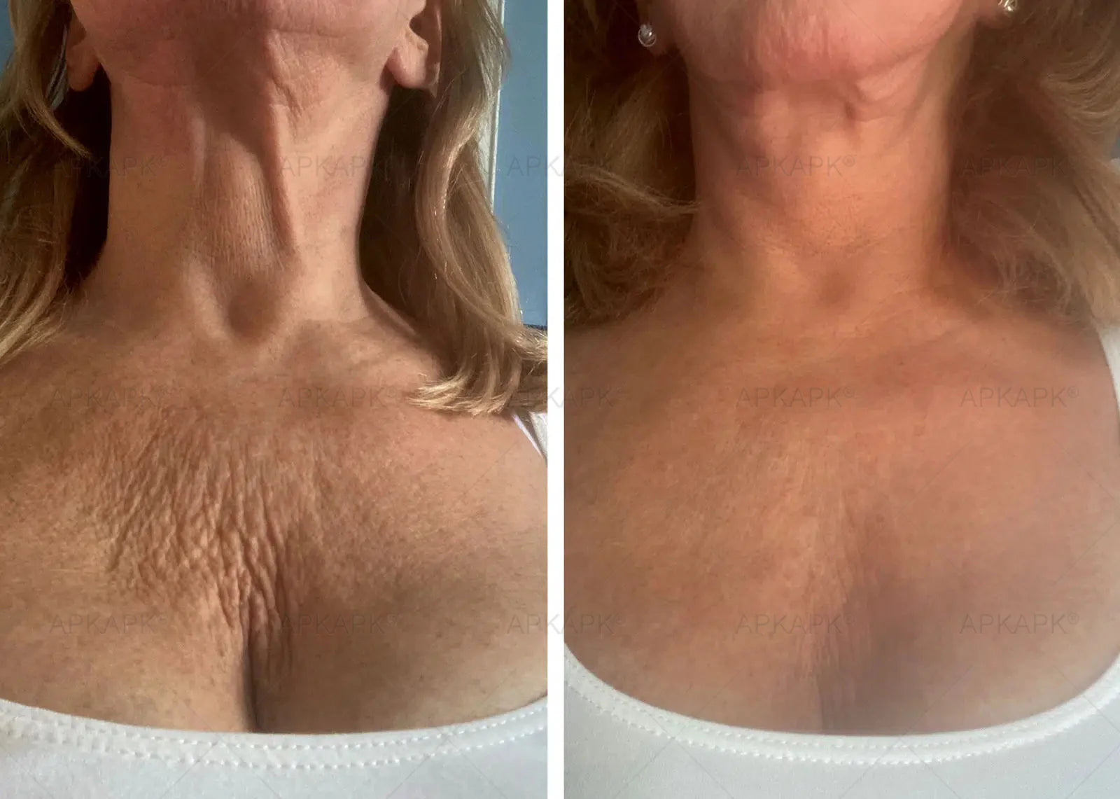 VeloraMist™ — Melt Away Pain and Glow with Youthful, Soothing Relief