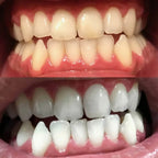 RadianceSwipe™ Whitening Pen — Unleash a Dazzling Smile That Commands Attention Instantly