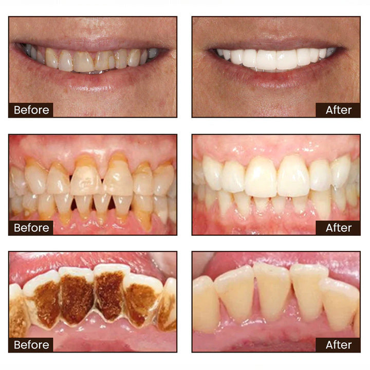 GlimmerDent™ — Reveal a Brilliant Smile That Heals and Empowers You Every Day