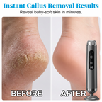 SilkStride™ Foot Resurfacer — Transform Rough Feet into Silky Confidence Instantly