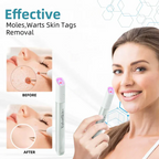 LumaClear™ — Precision Laser Power to Unleash Your Most Radiant, Confident Skin