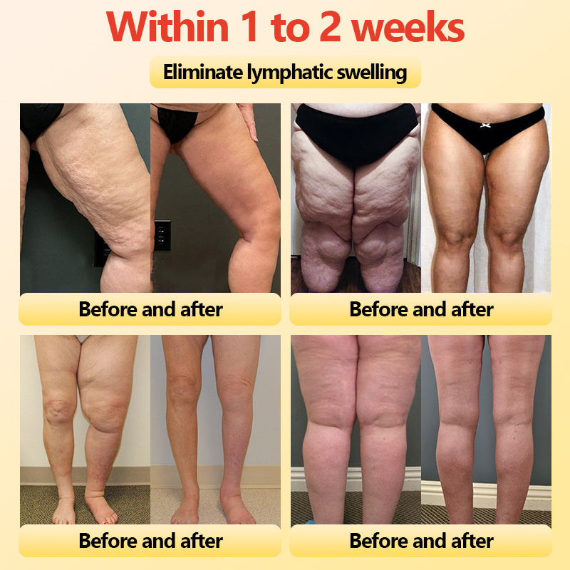 LumiThera™ — Feel the Deep Heat That Melts Fat, Calms Pain, and Reveals Radiant Skin