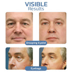 LumaLift™ — Instantly Revive Tired Eyes for a Youthful, Radiant Glow (1+1 FREE TODAY!)