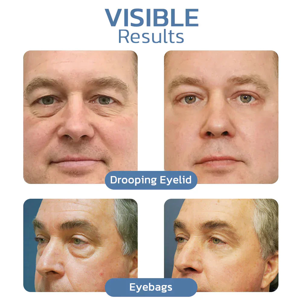 LumaLift™ — Instantly Revive Tired Eyes for a Youthful, Radiant Glow (1+1 FREE TODAY!)