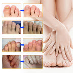 VeraNail™ — Clear, Confident Nails That Let You Bare Your Feet Proudly