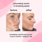GlowLuxe™ — Wake Up to Radiant, Spot-Free Skin Every Day