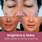 LumiClear™ Brightening Pads — Unleash Radiant Skin That Lights Up Your Confidence