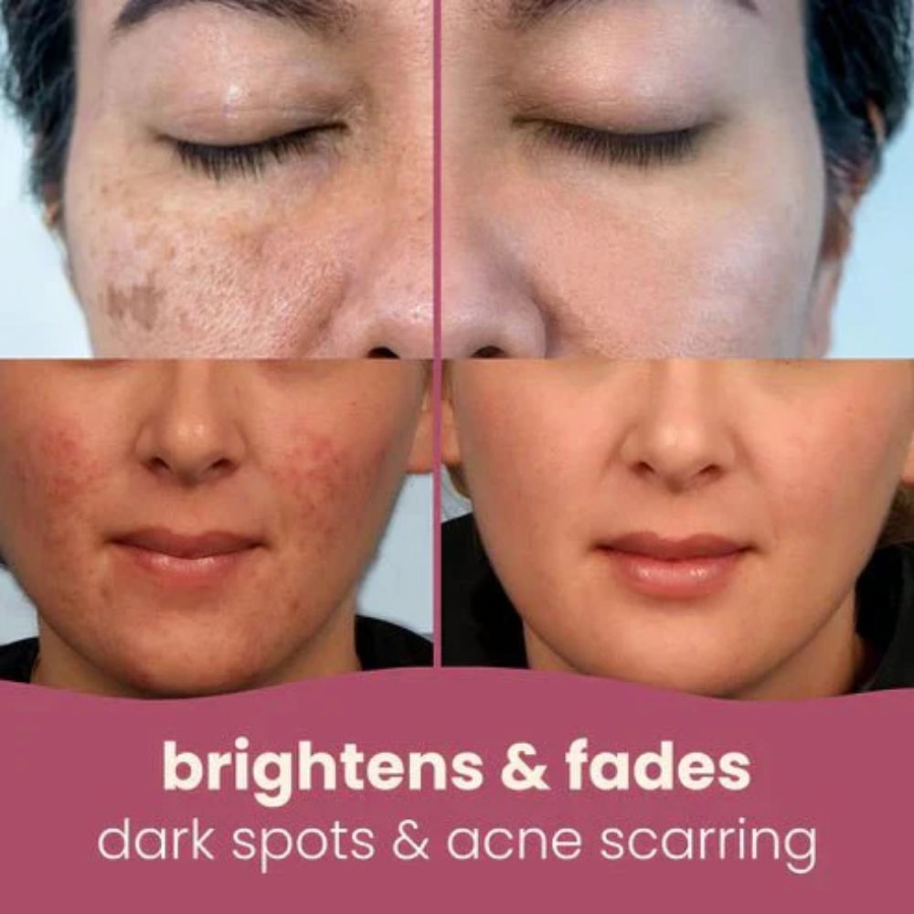 LumiClear™ Brightening Pads — Unleash Radiant Skin That Lights Up Your Confidence