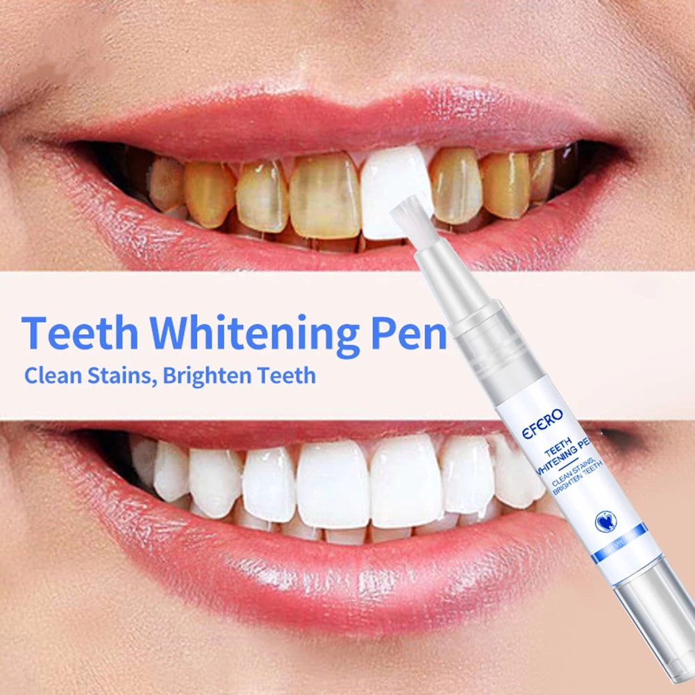 RadianceRush™ — Effortless Whitening That Ignites Unstoppable Confidence