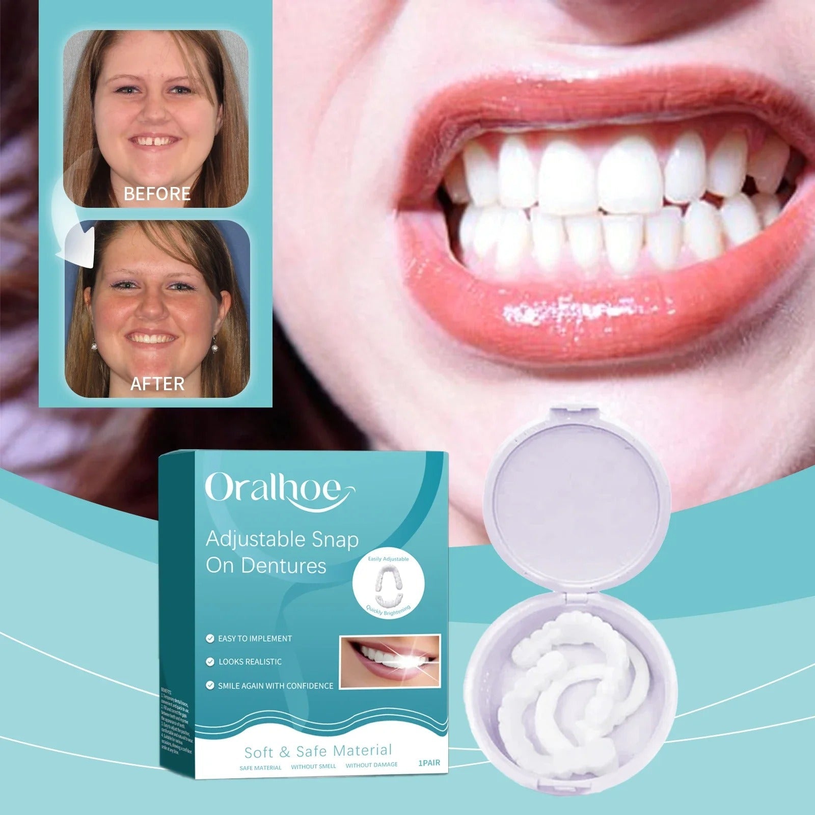 SmileSculpt™ — Own a Stunning, Confidence-Boosting Smile Instantly