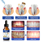 VivaDerm™ Oral Repair Elixir — Heal Your Gums Fast for a Pain-Free, Confident Smile