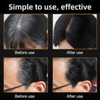 VividRoot™ Precision Pen — Instantly Reclaim a Youthful, Radiant You