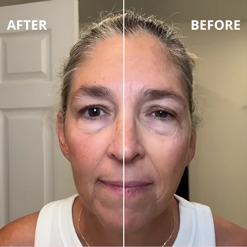 LymphEase™ — Sculpt a Radiant, Defined Face You’ll Love to Show Off