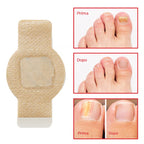 VeraNail™ — Clear, Confident Nails That Let You Bare Your Feet Proudly